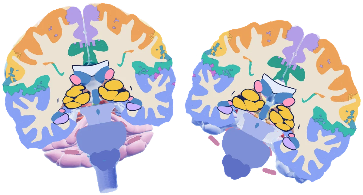 A real 3D brain cut front to back, from Slice the Brain